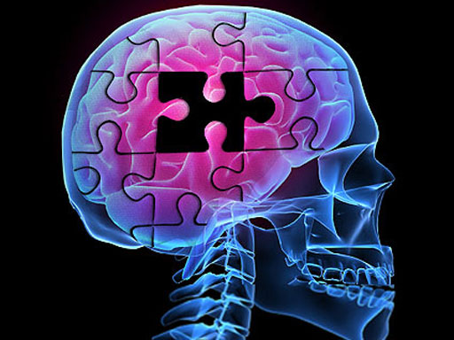 Omega-3 Can Help Alzheimer’s Disease New Study Suggest